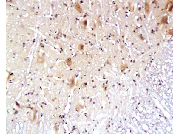 Formalin-fixed and paraffin embedded rat spinal cord tissue labeled with Anti-AQP4 Polyclonal Antibody, Unconjugated (bs-0634R) at 1:200, followed by conjugation to the secondary antibody and DAB staining
