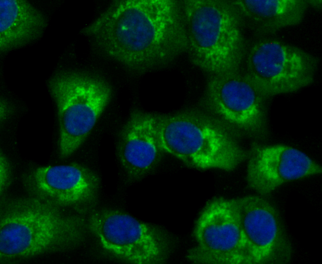IF(ICC) staining with TLR2 (3A27) Monoclonal Antibody (bsm-54147R) at 1:100 in A549 cells (green). The nuclear counterstain is DAPI (blue). Cells were fixed in paraformaldehyde, permeabilized with 0.25% Triton X100/PBS.