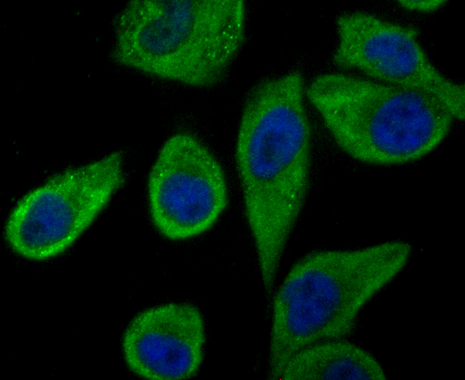 IF(ICC) staining with TLR2 (3A27) Monoclonal Antibody (bsm-54147R) at 1:100 in PC-M3 cells (green). The nuclear counterstain is DAPI (blue). Cells were fixed in paraformaldehyde, permeabilized with 0.25% Triton X100/PBS.
