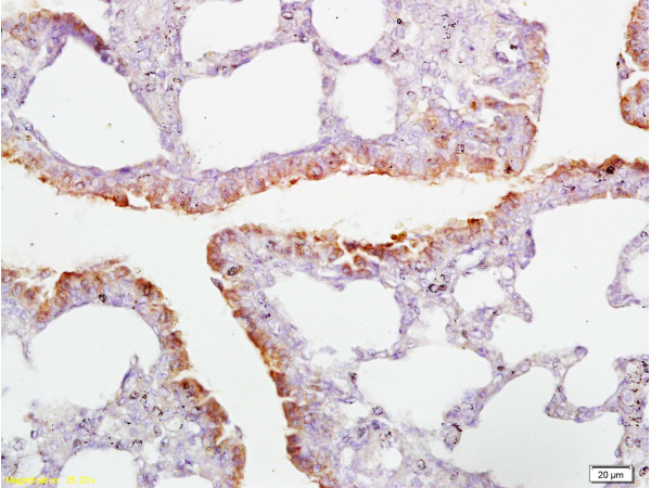 Formalin-fixed and paraffin embedded rat lung tissue labeled with Anti-CD2AP Polyclonal Antibody (bs-0512R) , Unconjugated at 1:200, followed by conjugation to the secondary antibody and DAB staining