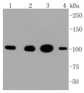 Lane 1: Hela cells; Lane 2: 293 cells; Lane 3: MCF-7 cells; Lane 4: HepG2 cells; Probed with Hexokinase 1 (7B9) Monoclonal Antibody (bsm-52452R) at 1:1000 overnight at 4°C followed by a conjugated secondary antibody for 60 minutes at 37°C.