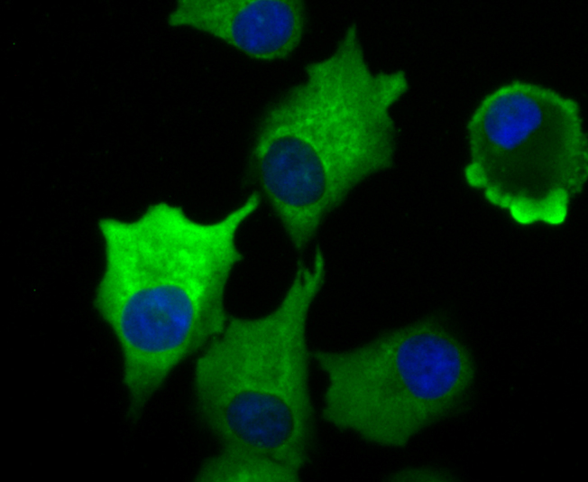 IF(ICC) staining with Vinculin (5G7) Monoclonal Antibody (bsm-54148R) at 1:100 in A549 cells (green). The nuclear counterstain is DAPI (blue). Cells were fixed in paraformaldehyde, permeabilized with 0.25% Triton X100/PBS.