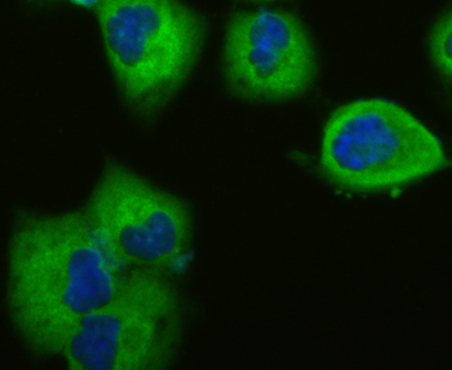IF(ICC) staining with Vinculin (5G7) Monoclonal Antibody (bsm-54148R) at 1:100 in HUVEC cells (green). The nuclear counterstain is DAPI (blue). Cells were fixed in paraformaldehyde, permeabilized with 0.25% Triton X100/PBS.
