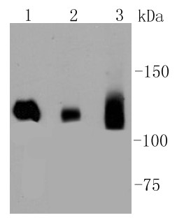Lane 1: Hela cells; Lane 2: Human brain; Lane 3: Human heart ; Probed with Dnmt3a (8A1) Monoclonal Antibody (bsm-52453R) at 1:1000 overnight at 4°C followed by a conjugated secondary antibody for 60 minutes at 37°C.