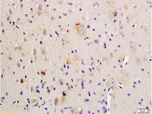 Formalin-fixed and paraffin embedded rat brain tissue labeled Anti-P38 MAPK(Phospho-Thr180\/Tyr182) Polyclonal Antibody, Unconjugated (bs-0636R) at 1:200, followed by conjugation to the secondary antibody and DAB staining