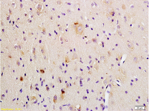 Formalin-fixed and paraffin embedded rat brain tissue labeled Anti-P38 MAPK(Phospho-Thr180/Tyr182) Polyclonal Antibody, Unconjugated (bs-0636R) at 1:200, followed by conjugation to the secondary antibody and DAB staining