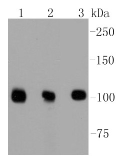 Lane 1: Hela cells; Lane 2: PC12 cells; Lane 3: NIH/3T3 cells; Probed with DGCR8 (3B11) Monoclonal Antibody (bsm-52454R) at 1:1000 overnight at 4°C followed by a conjugated secondary antibody for 60 minutes at 37°C.