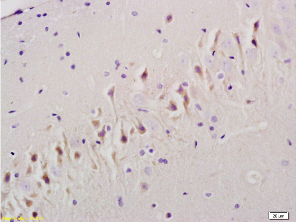 Formalin-fixed and paraffin embedded rat brain tissue labeled Anti-TGF Beta R1\/TGFBR1 Polyclonal Antibody, Unconjugated (bs-0638R) at 1:200, followed by conjugation to the secondary antibody and DAB staining