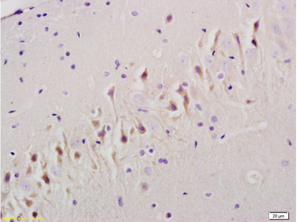 Formalin-fixed and paraffin embedded rat brain tissue labeled Anti-TGF Beta R1/TGFBR1 Polyclonal Antibody, Unconjugated (bs-0638R) at 1:200, followed by conjugation to the secondary antibody and DAB staining
