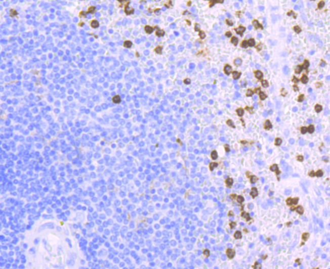 Paraformaldehyde-fixed and paraffin-embedded Human Spleen tissue incubated CD11b (9B3) Monoclonal Antibody (bsm-54156R) at 1:100, overnight at 4°C, followed by a conjugated secondary antibody and DAB staining. Counterstained with hematoxylin.