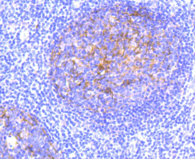 Paraformaldehyde-fixed and paraffin-embedded Human Tonsil tissue incubated CD11b (9B3) Monoclonal Antibody (bsm-54156R) at 1:100, overnight at 4°C, followed by a conjugated secondary antibody and DAB staining. Counterstained with hematoxylin.