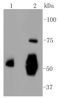 Lane 1: Human liver; Lane 2: Human serum; Probed with Vitronectin (7A1) Monoclonal Antibody (bsm-52460R) at 1:1000 overnight at 4°C followed by a conjugated secondary antibody for 60 minutes at 37°C.