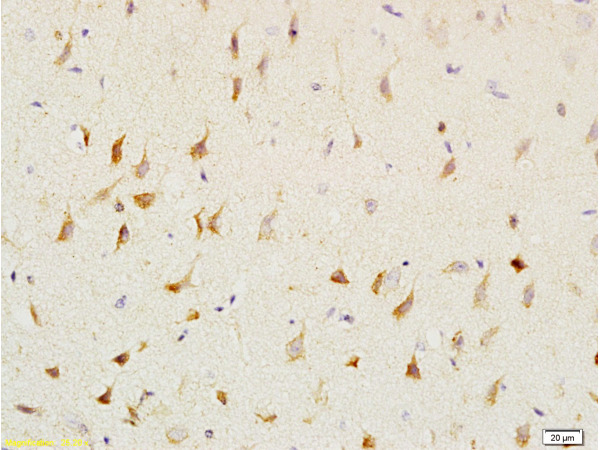 Formalin-fixed and paraffin embedded: rat brain tissue labeled with Anti-CNP/CNPase Polyclonal Antibody (bs-1000R), Unconjugated at 1:200, followed by conjugation to the secondary antibody and DAB staining
