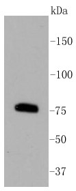 Raji cells Probed with PKC beta 2 (10A1) Monoclonal Antibody (bsm-52464R) at 1:1000 overnight at 4°C followed by a conjugated secondary antibody for 60 minutes at 37°C.