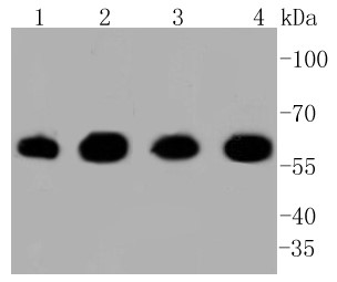 Lane 1: Hela cells; Lane 2: MCF-7 cells; Lane 3: PANC-1 cells; Lane 4: SW480 cells; Probed with Hsp60 (7G6) Monoclonal Antibody (bsm-52465R) at 1:1000 overnight at 4°C followed by a conjugated secondary antibody for 60 minutes at 37°C.