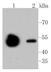 Lane 1: Mouse brain; Lane 2: Mouse kidney; Probed with beta Ⅱ Tubulin (48D2) Monoclonal Antibody (bsm-52467R) at 1:1000 overnight at 4°C followed by a conjugated secondary antibody for 60 minutes at 37°C.