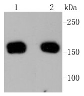Lane 1: A431 cells; Lane 2: NIH\/3T3 cells; Probed with ROCK1 (3A1) Monoclonal Antibody (bsm-52470R) at 1:1000 overnight at 4\u00b0C followed by a conjugated secondary antibody for 60 minutes at 37\u00b0C.