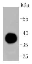 Human plasma probed with IgG4 (1A8) Monoclonal Antibody (bsm-52471R) at 1:1000 overnight at 4°C followed by a conjugated secondary antibody for 60 minutes at 37°C.