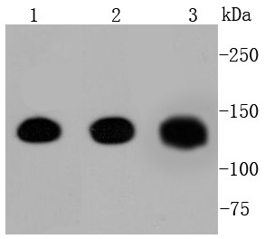 Lane 1: Human heart; Lane 2: Mouse heart; Lane 3: Rat heart lysate probed with Pan-Cadherin (9A1) Monoclonal Antibody (bsm-52480R) at 1:1000 overnight at 4°C followed by a conjugated secondary antibody for 60 minutes at 37°C.