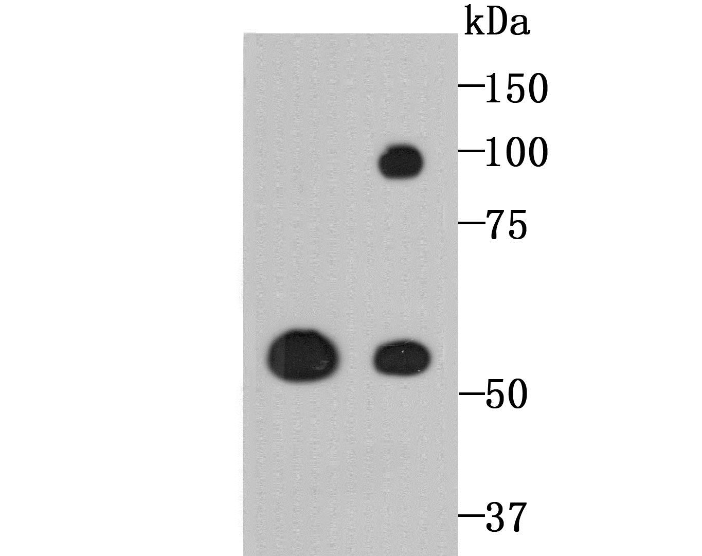Lane 1: PC-12 Cells; Lane 2: A549 Cells; Probed with LOXL2 (7D7) Monoclonal Antibody (bsm-54163R) at 1:500 overnight at 4°C followed by a conjugated secondary antibody for 60 minutes at 37°C.