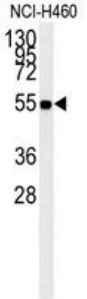 Lane 1: NCI-H460 Cells; 15 ug of protein lysate loaded; Probed with ALDH1A1 (2C2) Monoclonal Antibody (bsm-51032M) at 1:1000 overnight at 4°C followed by a conjugated secondary antibody for 60 minutes at 37°C.