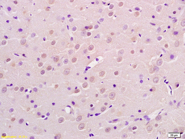 Formalin-fixed and paraffin embedded  rat brain labeled with  Rabbit Anti AP2 gamma Polyclonal Antibody, Unconjugated (bs-6694R) at 1:200 followed by conjugation to the secondary antibody and DAB staining