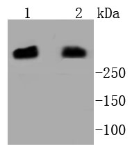 Lane 1: Hela Cells; Lane 2: MCF-7 Cells; Probed with DNA PKcs (36A1) Monoclonal Antibody (bsm-52493R) at 1:1000 overnight at 4°C followed by a conjugated secondary antibody for 60 minutes at 37°C Lane 1: Hela Cells; Lane 2: MCF-7 Cells; Probed with DNA PKcs (36A1) Monoclonal Antibody (bsm-52493R) at 1:1000 overnight at 4°C followed by a conjugated secondary antibody for 60 minutes at 37°C