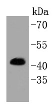 A431 cells probed with Erk1 (T202/Y204)+Erk2 (T185/Y187) (24F9) Monoclonal Antibody (bsm-52494R) at 1:1000 overnight at 4°C followed by a conjugated secondary antibody for 60 minutes at 37°C