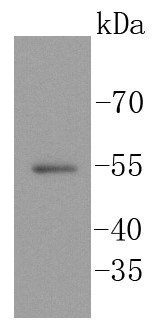 Human kidney probed with SGK1 (6D1) Monoclonal Antibody (bsm-52499R) at 1:1000 overnight at 4°C followed by a conjugated secondary antibody for 60 minutes at 37°C