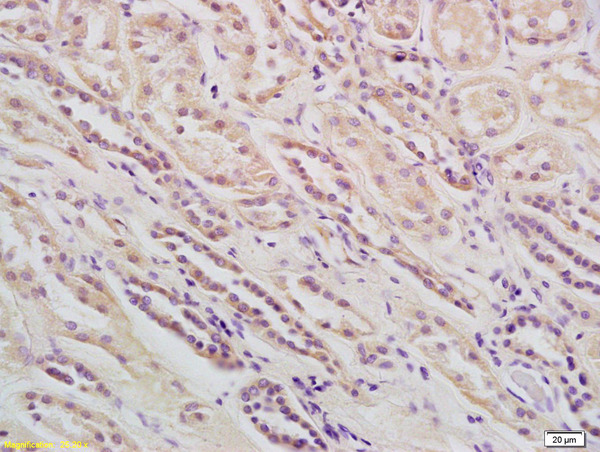 Formalin-fixed and paraffin embedded human kidney labeled with Rabbit Anti PLC β1/Phospholipase C beta 1 Polyclonal Antibody, Unconjugated (bs-6976R) at 1:200 followed by conjugation to the secondary antibody and DAB staining