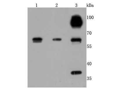 Lane 1: HepG2; Lane 2: Hela; Lane 3:A549 lysate probed with Cathepsin B (3C9) Monoclonal Antibody (bsm-52977R) at 1:500 overnight at 4°C followed by a conjugated secondary antibody for 60 minutes at 37°C.