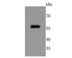 Rat brain cells lysates probed with NUR77 (1C1) Monoclonal Antibody (bsm-52972R) at 1:500 overnight at 4°C followed by a conjugated secondary antibody for 60 minutes at 37°C. Rat brain cells lysates probed with NUR77 (1C1) Monoclonal Antibody (bsm-52972R) at 1:500 overnight at 4°C followed by a conjugated secondary antibody for 60 minutes at 37°C.