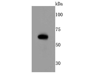 Mouse eyeball cells lysates probed with RPE65 (2C1) Monoclonal Antibody (bsm-52957R) at 1:500 overnight at 4°C followed by a conjugated secondary antibody for 60 minutes at 37°C._x000D_ _x000D_