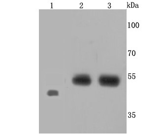 Lane 1: Zebrafish cells lysates; Lane 2: Raji cells lysates; Line 3: JAR cells lysates ;Probed with Endothelin B Receptor (4C5) Monoclonal Antibody (bsm-52954R) at 1:500 overnight at 4°C followed by a conjugated secondary antibody for 60 minutes at 37°C._x000D_ _x000D_