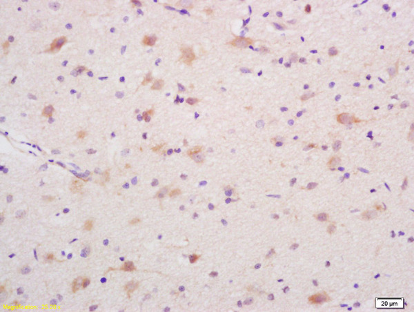 Formalin-fixed and paraffin embedded rat brain labeled with Rabbit Anti DEDD1 Polyclonal Antibody, Unconjugated (bs-7062R) at 1:200 followed by conjugation to the secondary antibody and DAB staining