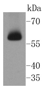 Hela cell lysate probed with Chk2 (7A4) Monoclonal Antibody (bsm-52522R) at 1:1000 overnight at 4°C followed by a conjugated secondary antibody for 60 minutes at 37°C. Hela cell lysate probed with Chk2 (7A4) Monoclonal Antibody (bsm-52522R) at 1:1000 overnight at 4°C followed by a conjugated secondary antibody for 60 minutes at 37°C.
