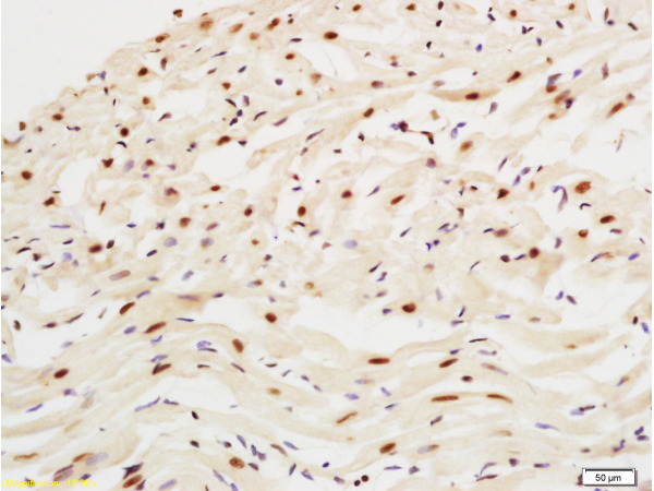 Formalin-fixed and paraffin embedded rat heart tissue labeled with Anti-PGC1 alpha Polyclonal Antibody, Unconjugated (bs-7535R) at 1:200 followed by conjugation to the secondary antibody and DAB staining