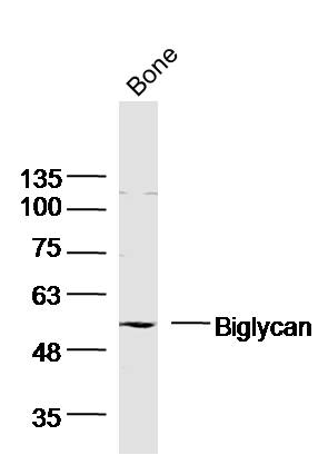 Mouse Bone probed with Biglycan Polyclonal Antibody (bs-7552R) at 1:300, overnight at 4˚C. Followed by incubation with a conjugated secondary antibody.