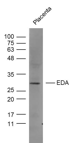 Mouse Placenta probed with EDA Polyclonal Antibody (bs-1149R) at 1:300, overnight at 4˚C._x000D_