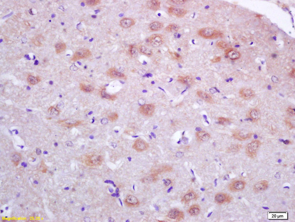 Formalin-fixed and paraffin embedded rat brain labeled with Anti-PRDX1 Polyclonal Antibody, Unconjugated (bs-3875R) at 1:200, followed by conjugation to the secondary antibody and DAB staining