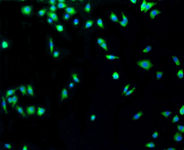 IF(ICC) staining with p53 (2F4) Monoclonal Antibody (bsm-52243R) at 1:100 in A549 cells (green). The nuclear counterstain is DAPI (blue). Cells were fixed in paraformaldehyde, permeabilized with 0.25% Triton X100/PBS.