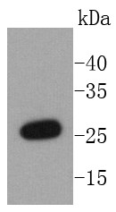 Hela cell lysate probed with NQO2 (3A3) Monoclonal Antibody (bsm-52563R) at 1:1000 overnight at 4°C followed by a conjugated secondary antibody for 60 minutes at 37°C. Hela cell lysate probed with NQO2 (3A3) Monoclonal Antibody (bsm-52563R) at 1:1000 overnight at 4°C followed by a conjugated secondary antibody for 60 minutes at 37°C.
