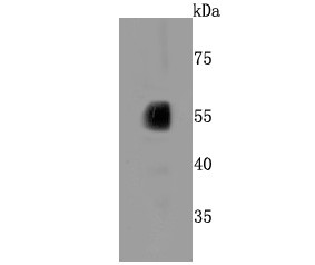 Human liver cells lysates probed with CYP2E1 (1A26) Monoclonal Antibody (bsm-52923R) at 1:500 overnight at 4°C followed by a conjugated secondary antibody for 60 minutes at 37°C. Human liver cells lysates probed with CYP2E1 (1A26) Monoclonal Antibody (bsm-52923R) at 1:500 overnight at 4°C followed by a conjugated secondary antibody for 60 minutes at 37°C.