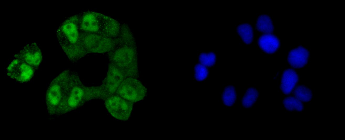 IF(ICC) staining with CREB (2B5) Monoclonal Antibody (bsm-52245R) at 1:100 in HeLa cells (green). The nuclear counterstain is DAPI (blue). Cells were fixed in paraformaldehyde, permeabilized with 0.25% Triton X100/PBS.
