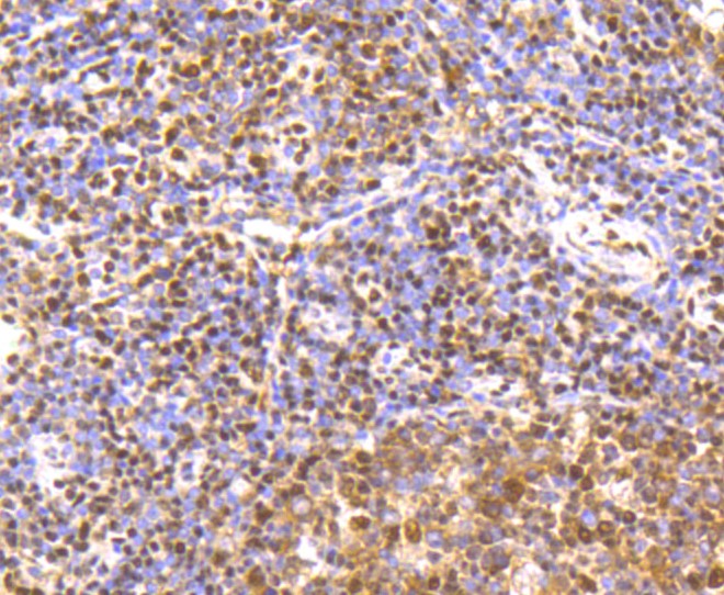 Paraformaldehyde-fixed and paraffin-embedded Human tonsil tissue incubated with CREB (2B5) Monoclonal Antibody (bsm-52245R) at 1:100, overnight at 4°C, followed by a conjugated secondary antibody and DAB staining. Counterstained with hematoxylin.