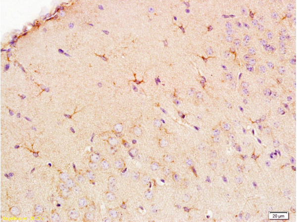 Formalin-fixed and paraffin embedded: rat brain tissue labeled with Anti-EAAT1\/GLAST Polyclonal Antibody (bs-1003R), Unconjugated at 1:200, followed by conjugation to the secondary antibody and DAB staining