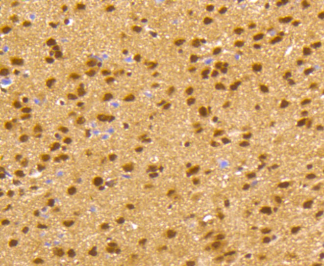 Paraformaldehyde-fixed and paraffin-embedded Mouse brain tissue incubated with CREB (2B5) Monoclonal Antibody (bsm-52245R) at 1:100, overnight at 4°C, followed by a conjugated secondary antibody and DAB staining. Counterstained with hematoxylin.