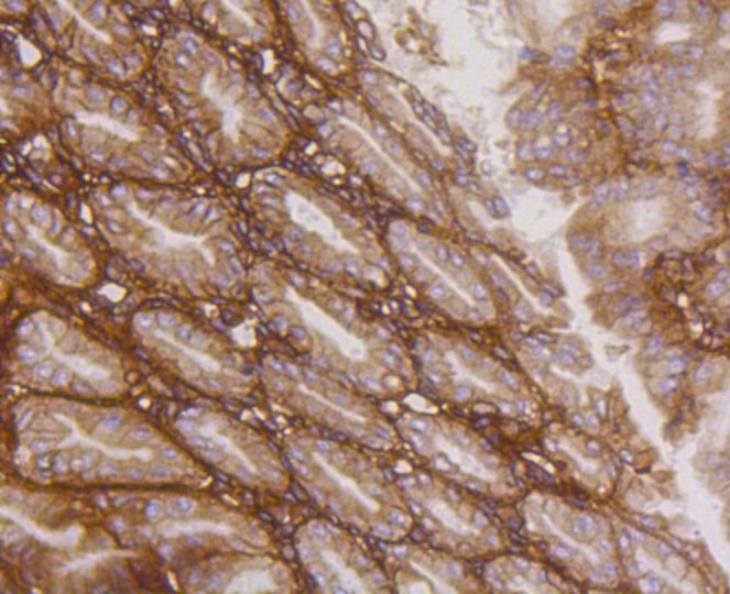 Paraformaldehyde-fixed and paraffin-embedded Mouse stomach tissue incubated with Integrin beta 1 (1G11) Monoclonal Antibody (bsm-52247R) at 1:100, overnight at 4°C, followed by a conjugated secondary antibody and DAB staining. Counterstained with hematoxylin.
