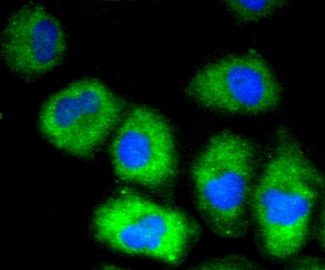 IF(ICC) staining with VCAM1 (24D1) Monoclonal Antibody (bsm-52248R) at 1:100 in HUVEC cells (green). The nuclear counterstain is DAPI (blue). Cells were fixed in paraformaldehyde, permeabilized with 0.25% Triton X100/PBS.