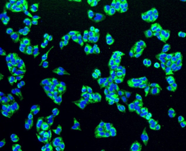 IF(ICC) staining with PBR (1D4) Monoclonal Antibody (bsm-52249R) at 1:100 in HeLa cells (green). The nuclear counterstain is DAPI (blue). Cells were fixed in paraformaldehyde, permeabilized with 0.25% Triton X100/PBS.